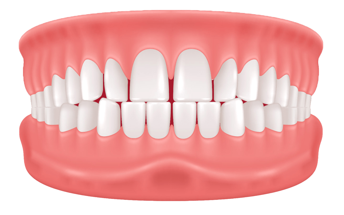 Illustration of a full set of adult human teeth and gums. The teeth are shown from the front, with both the upper and lower rows visible, displaying healthy and symmetrical alignment within pink gums.