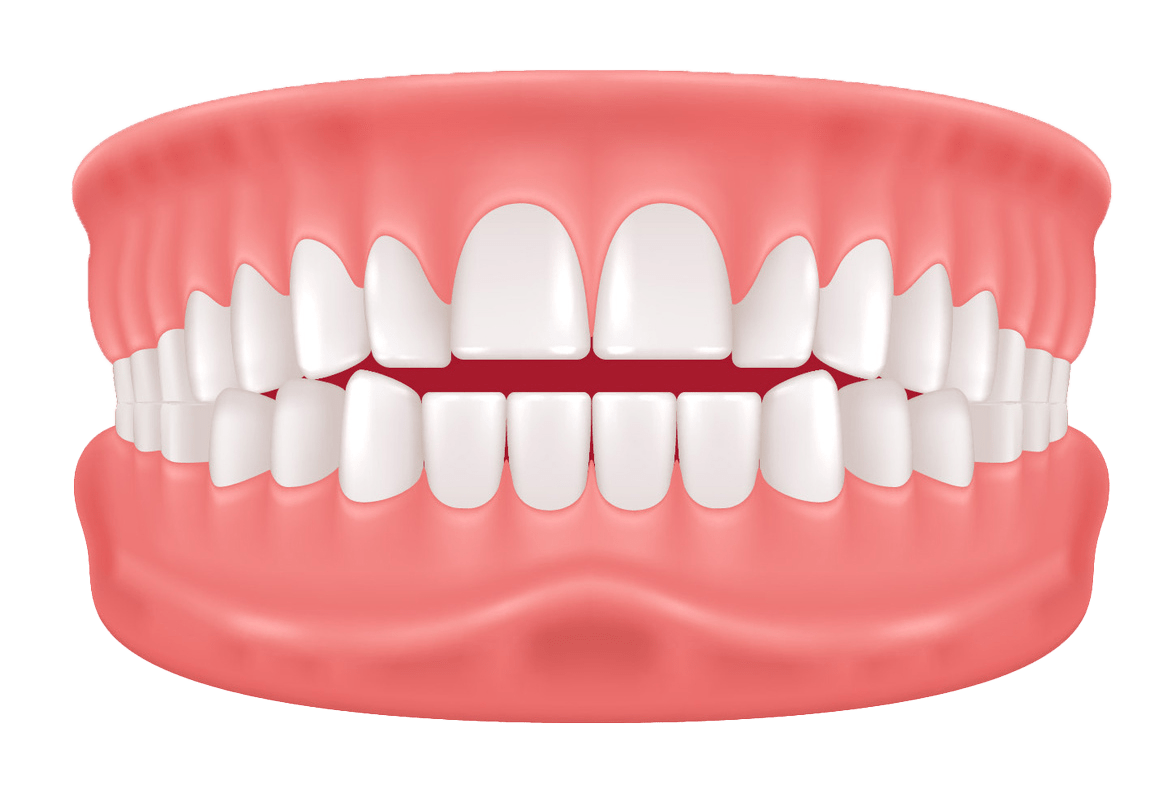 Illustration of a teeth model showing a full set of upper and lower teeth aligned in gums. The teeth are shown from the front, with the upper and lower rows slightly apart, highlighting the white teeth and pink gums.