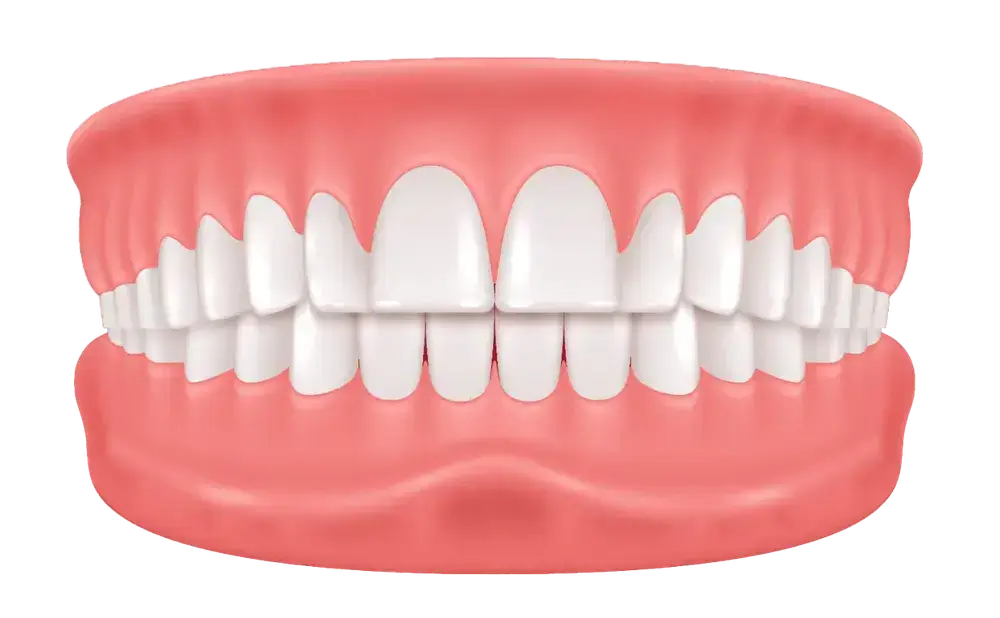 A digital illustration of a set of human teeth and gums, showing a full view of the upper and lower teeth with pink gums, slightly parted to reveal both rows clearly.