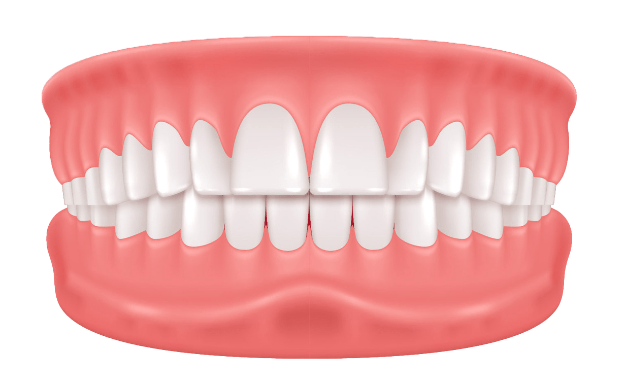 A digital illustration of a set of human teeth and gums, showing a full view of the upper and lower teeth with pink gums, slightly parted to reveal both rows clearly.
